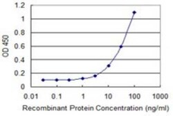 Novus Biologicals ACOT8 Antibody (3F1), Novus Biologicals 0.1 mg | Buy Online | Novus Biologicals&trade; | Fisher Scientific