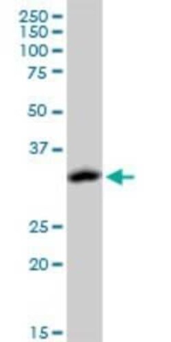 Novus Biologicals ACOT8 Antibody (3F1), Novus Biologicals 0.1 mg | Buy Online | Novus Biologicals&trade; | Fisher Scientific