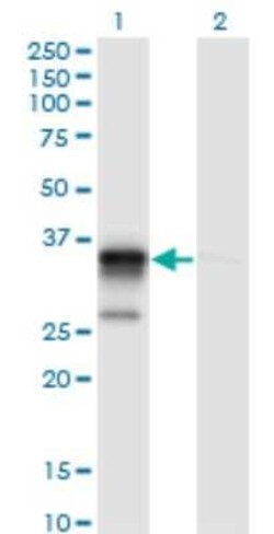 Novus Biologicals ACOT8 Antibody (3F1), Novus Biologicals 0.1 mg | Buy Online | Novus Biologicals&trade; | Fisher Scientific
