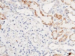 ACOX1 Antibody, Novus Biologicals 50 &mu;g; Unconjugated:Antibodies, Polyclonal