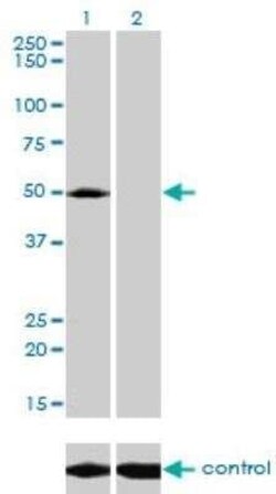 ACP2 Antibody (M1-4A12), Novus Biologicals 0.1 mg; Unconjugated:Antibodies,