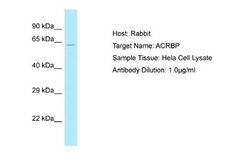 ACRBP Rabbit anti-Human, Polyclonal, Novus Biologicals 0.1 mL | Buy Online | Novus Biologicals | Fisher Scientific