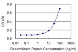 ACRC Antibody (2E4), Novus Biologicals 0.1 mg; Unconjugated:Antibodies,