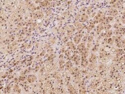 ACSBG1 Antibody, Novus Biologicals 100 &mu;g, Unconjugated:Antibodies,
