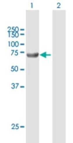 ACSBG2 Antibody, Novus Biologicals 0.05 mg; Unconjugated:Antibodies, Polyclonal