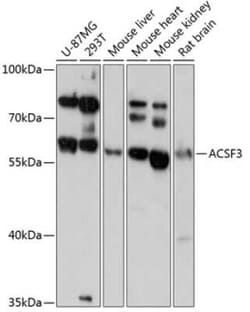 ACSF3 Antibody - Azide and BSA Free, Novus Biologicals:Antibodies:Primary