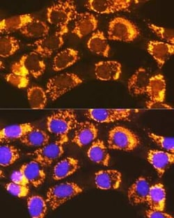 ACSL1 Antibody - Azide and BSA Free, Novus Biologicals:Antibodies:Primary