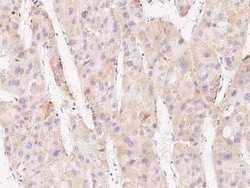 ACSL1 Antibody, Novus Biologicals:Antibodies:Primary Antibodies
