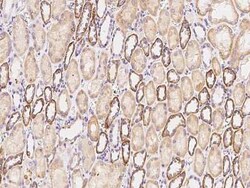 ACSL1 Antibody, Novus Biologicals:Antibodies:Primary Antibodies