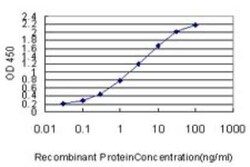 ACSL5 Antibody (5H8), Novus Biologicals 0.1 mg | Buy Online | Novus Biologicals | Fisher Scientific