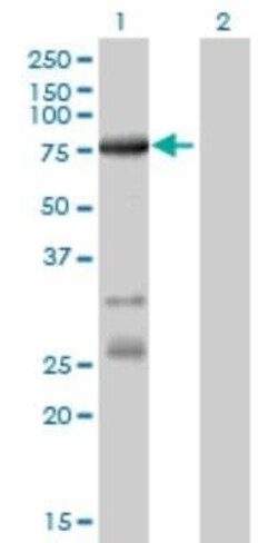 ACSL5 Antibody (5H8), Novus Biologicals 0.1 mg | Buy Online | Novus Biologicals | Fisher Scientific