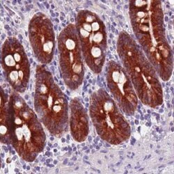 ACSL5 Antibody (CL0275), Novus Biologicals 25 &mu;L, Unconjugated:Antibodies,
