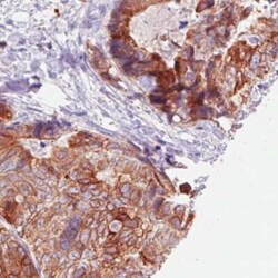 ACSL5 Antibody (CL0275), Novus Biologicals 25 &mu;L, Unconjugated:Antibodies,