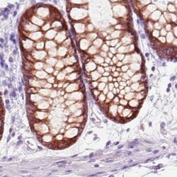 ACSL5 Antibody (CL0275), Novus Biologicals 25 &mu;L, Unconjugated:Antibodies,