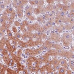 ACSL5 Antibody (CL0275), Novus Biologicals 25 &mu;L, Unconjugated:Antibodies,