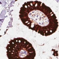 ACSL5 Antibody (CL0275), Novus Biologicals 25 &mu;L, Unconjugated:Antibodies,