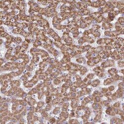 ACSM2A Antibody, Novus Biologicals:Antibodies:Primary Antibodies