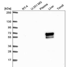 ACSM2A Antibody, Novus Biologicals:Antibodies:Primary Antibodies