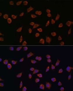 ACSS1 Antibody - Azide and BSA Free, Novus Biologicals:Antibodies:Primary