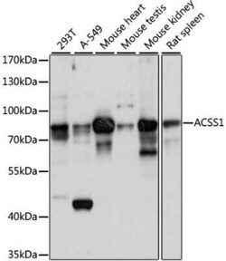 ACSS1 Antibody - Azide and BSA Free, Novus Biologicals:Antibodies:Primary