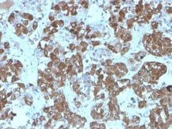 ACTH Mouse anti-Human, Mouse, Rat, Clone: rCLIP/1407, Novus Biologicals