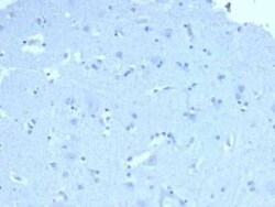 ACTH Antibody (57) - N-terminal - Azide and BSA Free, Novus Biologicals