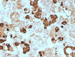ACTH Antibody (57) - N-terminal - Azide and BSA Free, Novus Biologicals