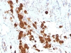 Novus Biologicals ACTH Antibody (SPM333) - Azide and BSA Free, Novus Biologicals