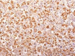 ACTH Antibody (r57) - N-terminal, Novus Biologicals:Antibodies:Primary