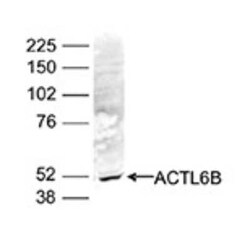 ACTL6B Rabbit anti-Human, Polyclonal, Novus Biologicals:Antibodies:Primary