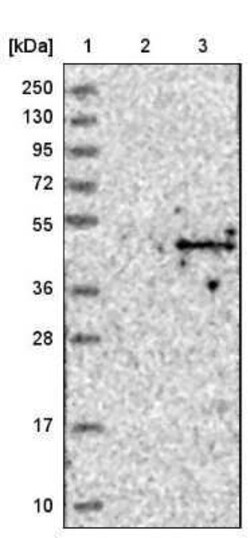 ACTL8 Antibody, Novus Biologicals 0.1 mL | Buy Online | Novus Biologicals | Fisher Scientific