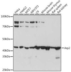 ACTR2 Rabbit anti-Human, Mouse, Rat, Clone: 6B1I3, Novus Biologicals 20
