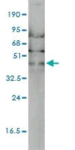 ACTR2 Antibody (1B10-C4), Novus Biologicals 0.1 mg | Buy Online | Novus Biologicals | Fisher Scientific