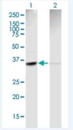 ACTR2 Antibody, Novus Biologicals 50 &mu;g | Buy Online | Novus Biologicals | Fisher Scientific
