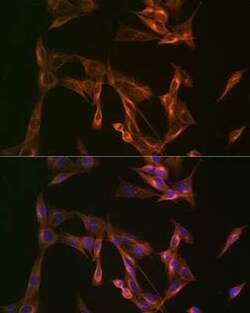 ACTR3 Rabbit anti-Human, Mouse, Rat, Clone: 8K4F2, Novus Biologicals 100 &mu;g | Buy Online | Novus Biologicals | Fisher Scientific