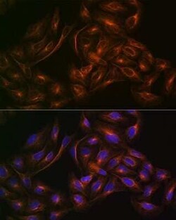 ACTR3 Rabbit anti-Human, Mouse, Rat, Clone: 8K4F2, Novus Biologicals 100 &mu;g | Buy Online | Novus Biologicals | Fisher Scientific