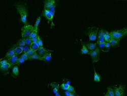 ACY3 Antibody, Novus Biologicals:Antibodies:Primary Antibodies