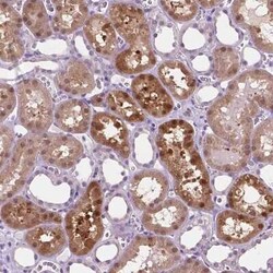 ACY3 Antibody, Novus Biologicals:Antibodies:Primary Antibodies