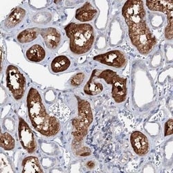 ACY3 Antibody, Novus Biologicals:Antibodies:Primary Antibodies