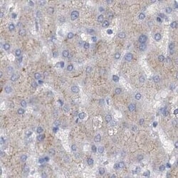 ACY3 Antibody, Novus Biologicals:Antibodies:Primary Antibodies