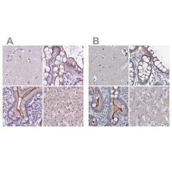 ACY3 Antibody, Novus Biologicals:Antibodies:Primary Antibodies