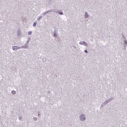 ACY3 Antibody, Novus Biologicals:Antibodies:Primary Antibodies