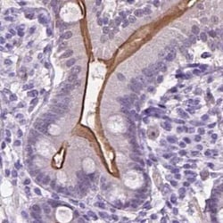 ACY3 Antibody, Novus Biologicals:Antibodies:Primary Antibodies