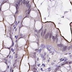ACY3 Antibody, Novus Biologicals:Antibodies:Primary Antibodies