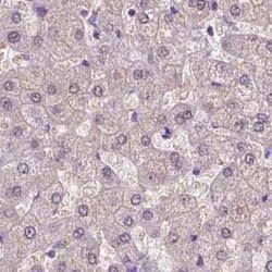 ACY3 Antibody, Novus Biologicals:Antibodies:Primary Antibodies