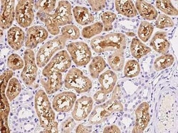 ACY3 Antibody, Novus Biologicals:Antibodies:Primary Antibodies