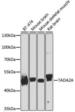 ADA2a Antibody - BSA Free, Novus Biologicals:Antibodies:Primary Antibodies