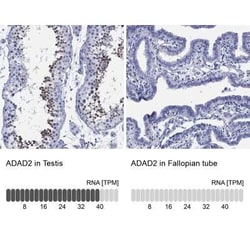 ADAD2 Rabbit anti-Human, Polyclonal, Novus Biologicals 25 &mu;g; Unconjugated:Antibodies,
