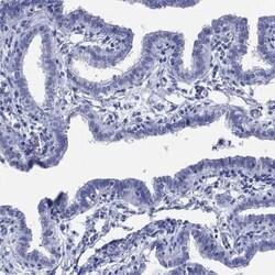 ADAD2 Rabbit anti-Human, Polyclonal, Novus Biologicals 25 &mu;g; Unconjugated:Antibodies,