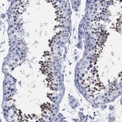ADAD2 Rabbit anti-Human, Polyclonal, Novus Biologicals 25 &mu;g; Unconjugated:Antibodies,